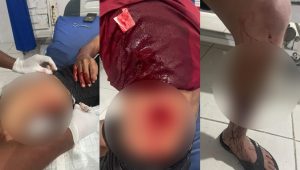 Utang Piutang Tak Lunas Berujung Penikaman