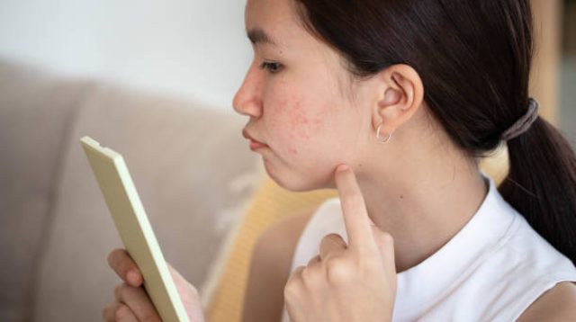 7 Cara Melindungi Kulit dari Alergi agar Tetap Sehat, Lembap, dan Bebas Iritasi
