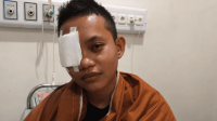 Nestapa Keluarga asal Morut Ditagih Biaya Berobat Rp42 Juta setelah Kehilangan Mata Kanan