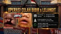 Polri Gelar Operasi Celah Bibir dan Lelangit Gratis di Palu, Screening Dibuka 17–18 Agustus